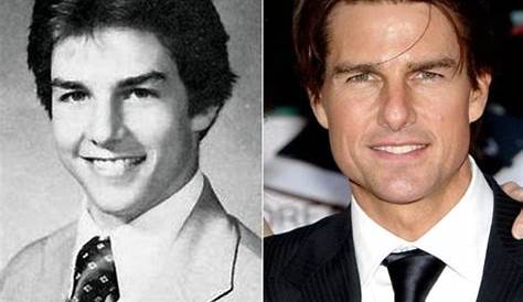 Tom Cruise Plastic Surgery Before & After | Plastic surgery, Plastic