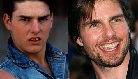 Tom Cruise Has One of Hollywood’s Most Famous Smiles! The Story Behind