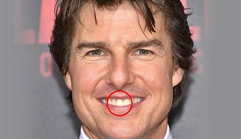 Tom Cruise Teeth Off Center / Tom Cruise S Weird Middle Tooth Harry
