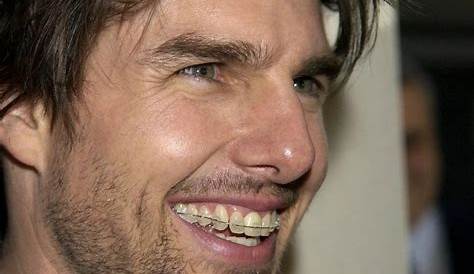 Tom Cruise's Dental Journey — What's Up With His Middle Tooth?