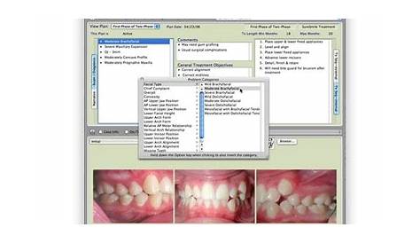 Tops Ortho Software Manual