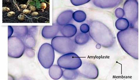 cellules de pomme de terre amyloplastes | Vive les SVT ! Les sciences