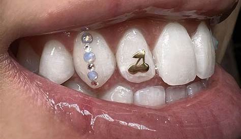 Unveiling The Allure Of Tyla Tooth Gems: A Journey Of Discovery