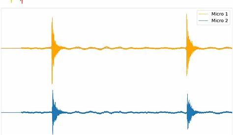 Les ondes - Exercice : Onde ultrasonore