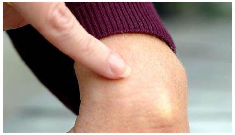 Ganglion Bilder Science Photo Library