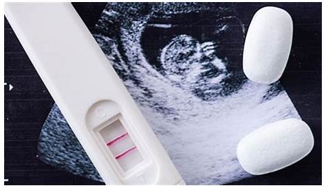 Schwangerschaftsabbruch: Bis wann ist ein Schwangerschaftsabbruch möglich?