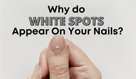 What Causes A White Spot On Your Nail Those Dots Fingernils Cn