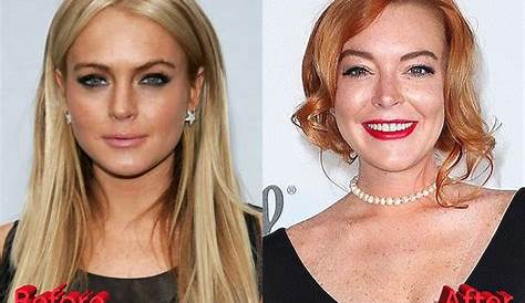 Unveiling Lindsay Lohan's Cosmetic Enhancements: An Inside Look