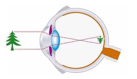 Aufbau des Auges (inkl. Grafik und Video)