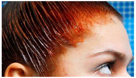 Will Bleach Remove HairDye From Skin?