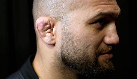√ Why Do Ufc Fighters Ears Look Weird / Proper Treatment For