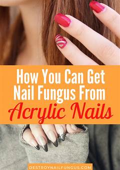 Can You Put Acrylic Nails Over Fungus?