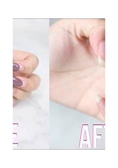 How To Take Off Acrylic Nails With Hydrogen Peroxide