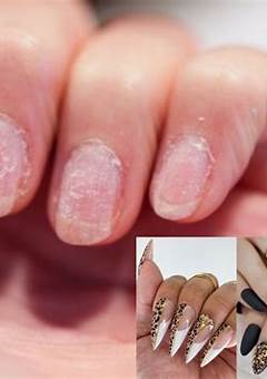Nails After Acrylics - Tips And Care In 2023