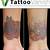 Best Tattoo Removal Products