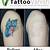 Blue Tattoo Removal Before And After