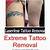 Certification For Tattoo Removal