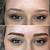 Eyebrows Tattoo Removal
