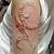 Henna Tattoo Scar