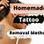 Home Tattoo Removal Methods