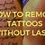 How Can I Remove My Tattoo Without Laser