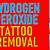 Hydrogen Peroxide Tattoo Removal