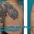 Large Tattoo Removal Cost