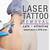 Laser Tattoo Removal Dallas