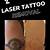 Laser Tattoo Removal Fresno Ca