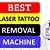 Laser Tattoo Removal Machine Reviews
