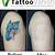 Tattoo Removal Advice