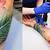 Tattoo Removal Blue Ink