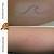 Tattoo Scar Removal