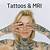 Tattoos And Mri