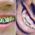 Teeth Tattoos