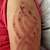 henna tattoo allergic reaction