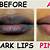 home remedies for black lips to pink