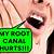 how long does it take to get a root canal