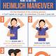 Free Printable Heimlich Maneuver Poster