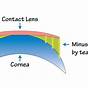 Vertex Chart Contact Lenses