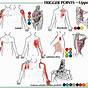 Trigger Point Referred Pain Chart