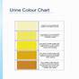 Urine Colour Chart Nhs