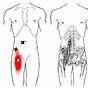 Trigger Point Referred Pain Chart