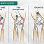 Knee Pain Location Diagram Symptoms