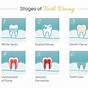 Tooth Decay Cavity Vs Stain Chart