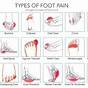 Under Foot Pain Chart