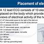 Ems Electrode Placement Chart Pdf