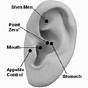 Ear Seed Placement Chart For Migraines