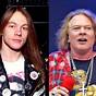 Axl Rose Then And Now