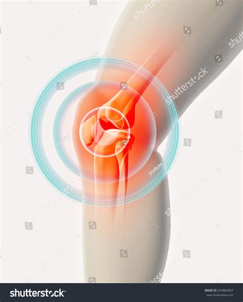 Physical Therapy Runners Photos Images Pictures Shutterstock